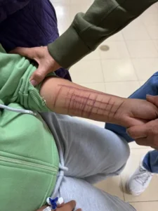AUTOLESIONES - RTH ROGELIO TRUJILLO MEDICO PSIQUIATRA